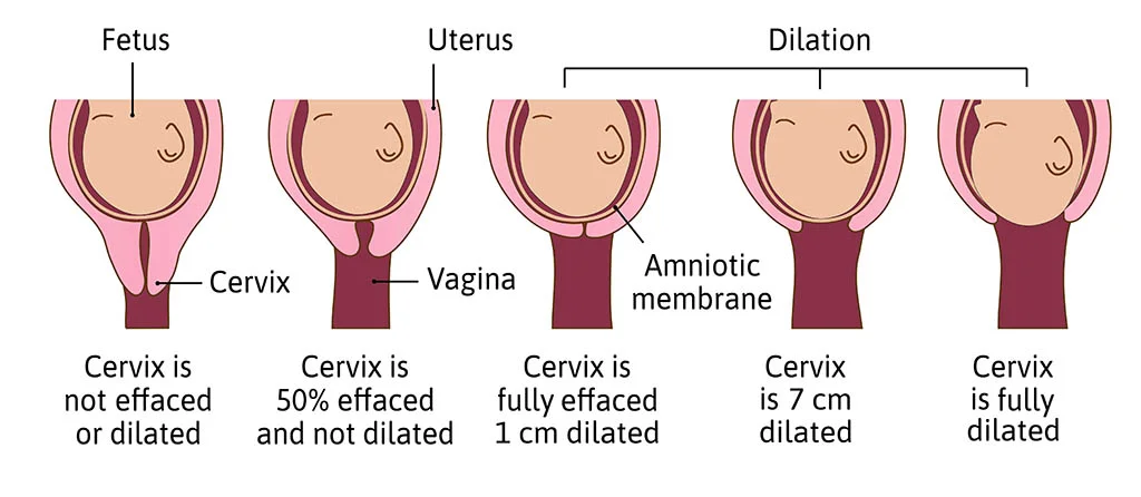 Does Your Vagina Get Loose After Birth